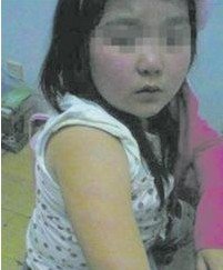 小學(xué)生沒考100分被老師打 兩個(gè)月不敢上學(xué) 小學(xué)生沒考100分被老師打 兩個(gè)月不敢上學(xué)