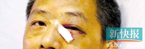 ■這起醫(yī)鬧事件，受傷的遠(yuǎn)遠(yuǎn)不只是熊旭明醫(yī)生的身體。