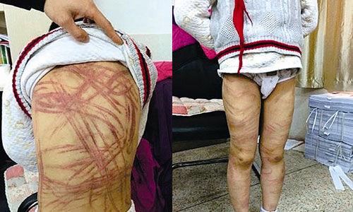 南京虐童案養母致歉:將用加倍關愛彌補過失 南京虐童案養母致歉:將用加倍關愛彌補過失