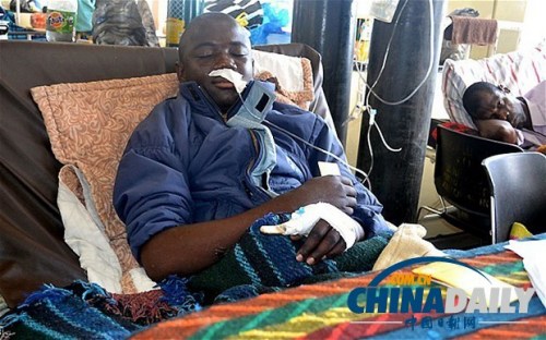 雖然已經在醫院接受了近一個月的恢復治療，卡托卡的身體仍然非常虛弱。