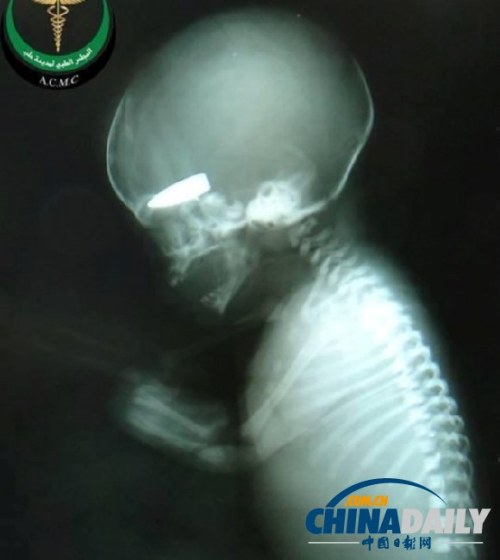 外媒曝敘軍拿孕婦當游戲標靶 射死胎兒獲香煙 外媒曝敘軍拿孕婦當游戲標靶 射死胎兒獲香煙