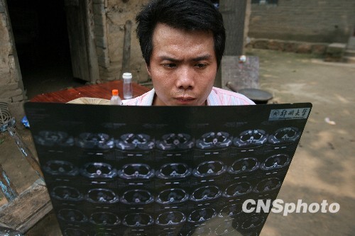 河南"開胸驗肺者"低保被取消 河南"開胸驗肺者"低保被取消