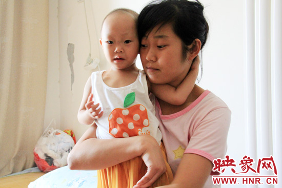 孩子和媽媽在一起,她的右眼已經失明。 孩子和媽媽在一起,她的右眼已經失明。