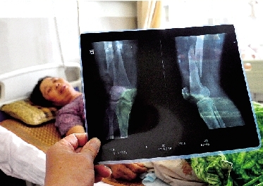 女環(huán)衛(wèi)工不慎墜入人行道深坑 施工方匆匆填坑回應(yīng)含糊 女環(huán)衛(wèi)工不慎墜入人行道深坑 施工方匆匆填坑回應(yīng)含糊