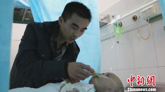 河南掉油鍋重傷女童4次植皮已轉出重癥監護室 河南掉油鍋重傷女童4次植皮已轉出重癥監護室