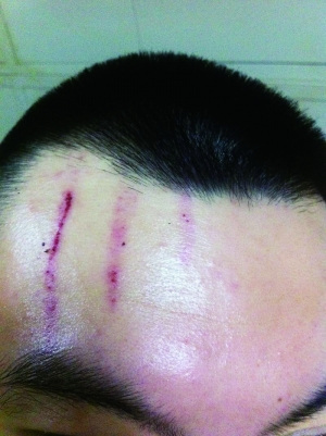 2013年,被打者受傷照 2013年,被打者受傷照