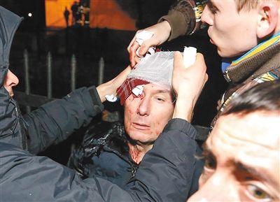 11日,基輔,遇襲受傷的反對派領(lǐng)導(dǎo)人盧岑科接受簡單救護(hù)。 11日,基輔,遇襲受傷的反對派領(lǐng)導(dǎo)人盧岑科接受簡單救護(hù)。