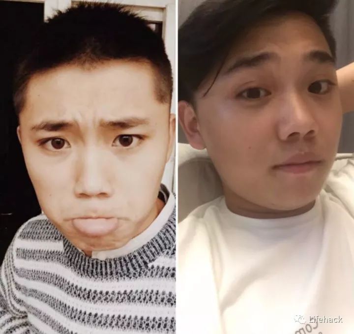 長胖20斤,臉型怎么變?這些例子看完扎心了!