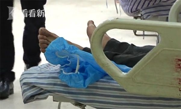 黃鱔從肛門鉆進肚子 男子被送醫不愿多談事情經過