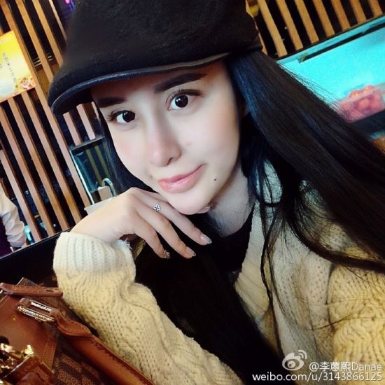 15歲少女為情整容變蛇妖 一夜爆紅 15歲少女為情整容變蛇妖 一夜爆紅