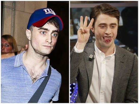 丹尼爾日前被拍到骨瘦如柴,不似2月份健康 丹尼爾日前被拍到骨瘦如柴,不似2月份健康