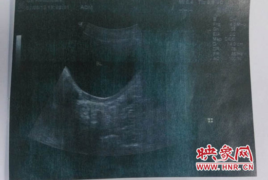 鄭州大學第三附屬醫院鑒定 鄭州大學第三附屬醫院鑒定