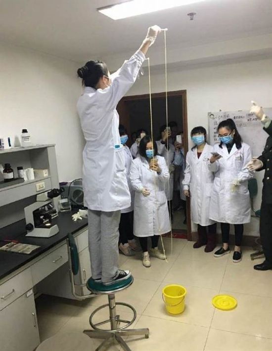 愛吃生肉惹的禍!男子體內取出5米長寄生蟲(圖) 愛吃生肉惹的禍!男子體內取出5米長寄生蟲(圖)