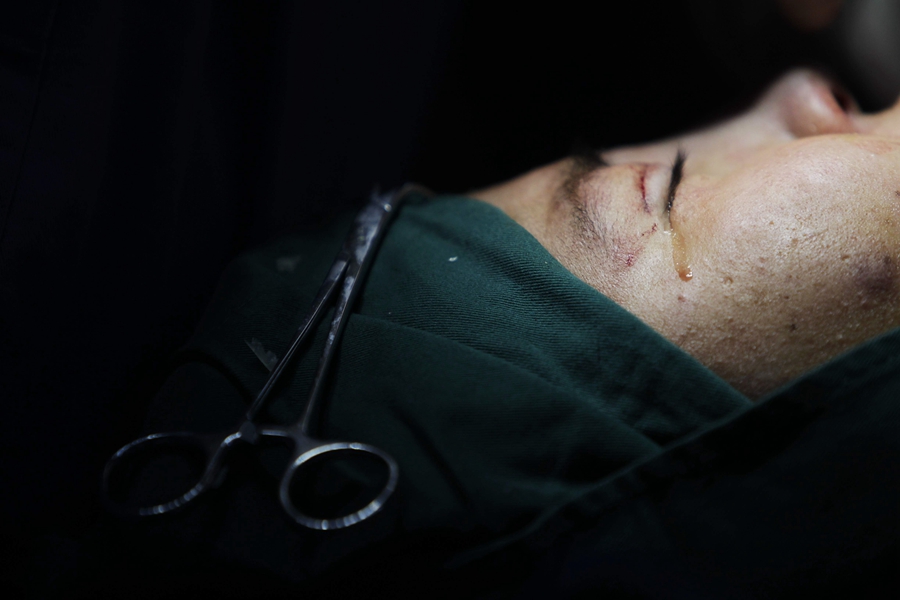 躺在手術(shù)臺(tái)上的一刻,她流下了眼淚。那里面,滿含著對(duì)美麗的忐忑和憧憬。 躺在手術(shù)臺(tái)上的一刻,她流下了眼淚。那里面,滿含著對(duì)美麗的忐忑和憧憬。