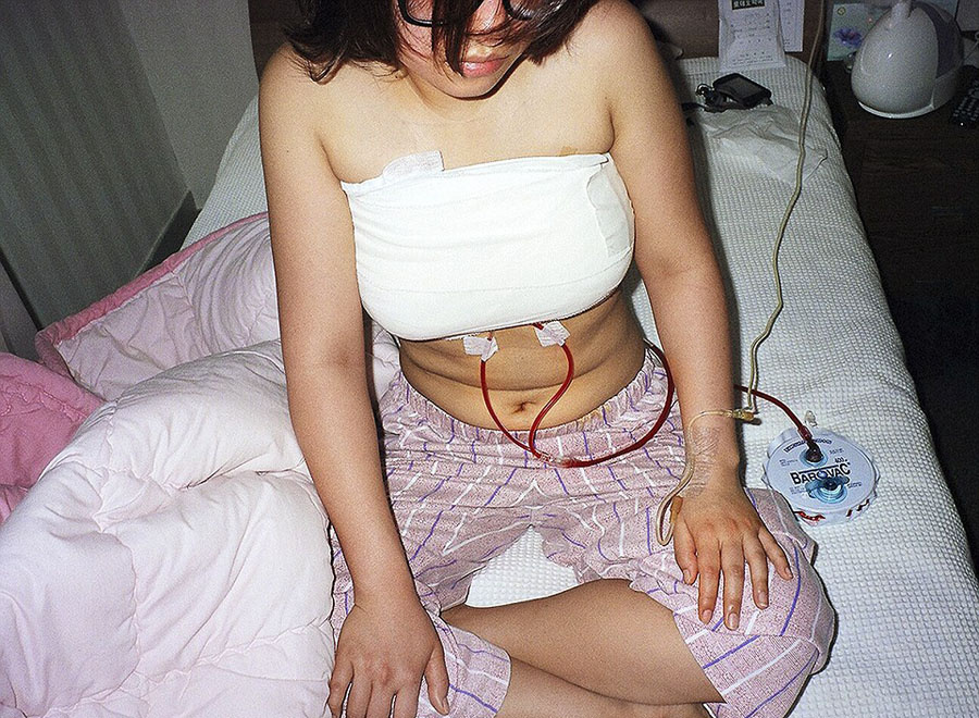 韓攝影師鏡頭記錄患者整容術后的生活 韓攝影師鏡頭記錄患者整容術后的生活