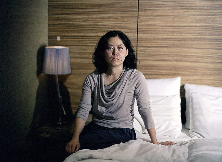 韓攝影師鏡頭記錄患者整容術后的生活 韓攝影師鏡頭記錄患者整容術后的生活