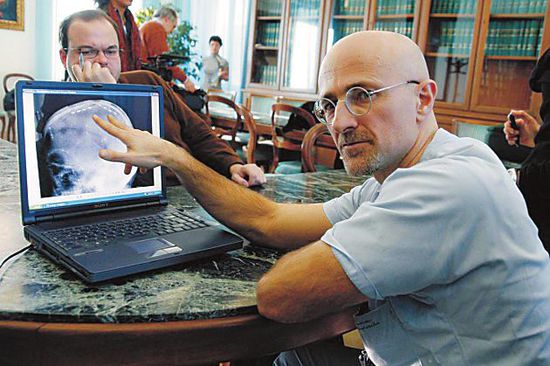 圖為卡納維洛醫生,不少人認為他的想法非常瘋狂 圖為卡納維洛醫生,不少人認為他的想法非常瘋狂