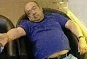 網(wǎng)傳金正男中毒后的照片。