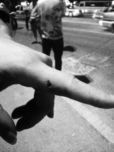 民警食指被咬傷。 民警食指被咬傷。