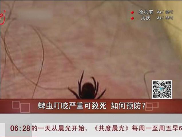 蜱蟲(chóng)叮咬嚴(yán)重可致死如何預(yù)防？